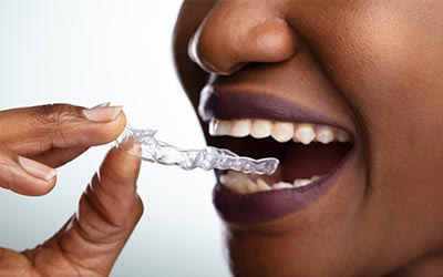 woman putting her ClearCorrect aligners in