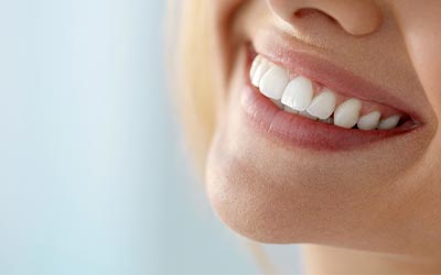 patient showing off her whitened teeth