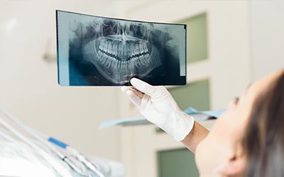 dentist reviewing x-rays