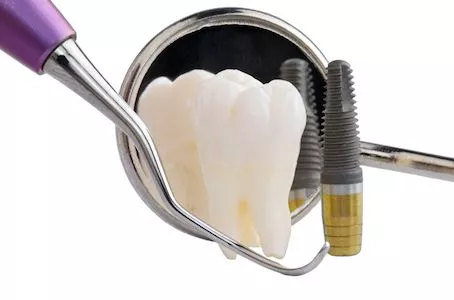 dental implant tools